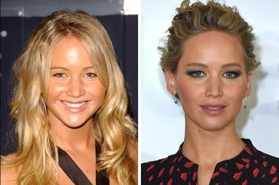 A picture of Jennifer Lawrence before (left) and after (right).